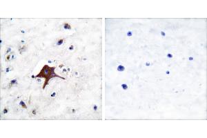 Peptide - +Immunohistochemical analysis of paraffin-embedded human brain tissue using GLUT3 antibody (#C0214).