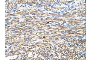 anti-Muscleblind-like Protein 1 (MBNL1) (AA 211-260) antibody