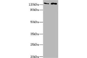 Western blot All lanes: KDM4B antibody at 4 μg/mL Lane 1: Jurkat whole cell lysate Lane 2: k562 whole cell lysate Secondary Goat polyclonal to rabbit IgG at 1/10000 dilution Predicted band size: 122, 51 kDa Observed band size: 122 kDa (KDM4B anticorps  (AA 1-260))