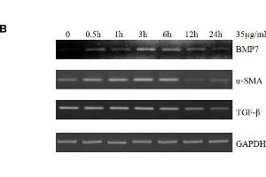 Butylidenephthalide reduces EMT-related gene expression in dosage dependent manner in vivo and in cultured HSCs.