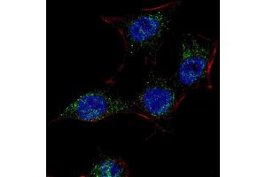 Fluorescent confocal image of HeLa cells stained with SC (Center) antibody.