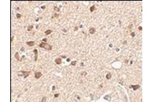 Immunohistochemistry of Stk39 in human brain tissue with this product at 2. (STK39 anticorps  (Center))