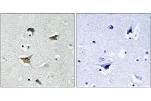Immunohistochemistry analysis of paraffin-embedded human brain tissue, using FAK (Ab-397) Antibody.