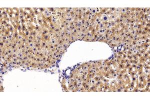 Detection of ALT in Mouse Liver Tissue using Polyclonal Antibody to Alanine Aminotransferase (ALT)