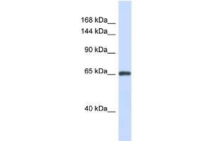 Host:  Rabbit  Target Name:  ZNF280D  Sample Type:  Fetal Brain lysates  Antibody Dilution:  1. (ZNF280D anticorps  (N-Term))