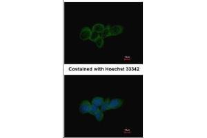 ICC/IF Image Immunofluorescence analysis of methanol-fixed A431, using LDHA, antibody at 1:500 dilution. (Lactate Dehydrogenase A anticorps)