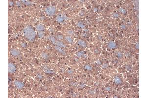 IHC analysis of GABA(A)R Beta 3 in frozen sections of mouse brain extract using GABRB3 antibody. (GABRB3 anticorps  (AA 370-433))