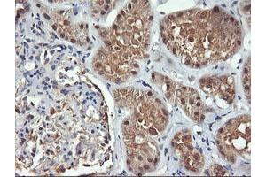 Image no. 5 for anti-F-Box Protein 21 (FBXO21) antibody (ABIN1498234)