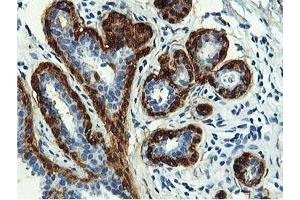 Immunohistochemical staining of paraffin-embedded Human breast tissue using anti-TAGLN mouse monoclonal antibody. (Transgelin anticorps)