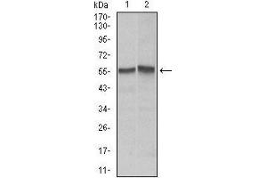 Western blot analysis using FAS mouse mAb against Hela (1), Jurkat (2) cell lysate. (FAS anticorps)