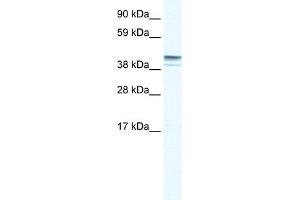 WB Suggested Anti-ZNF627 Antibody Titration:  0.