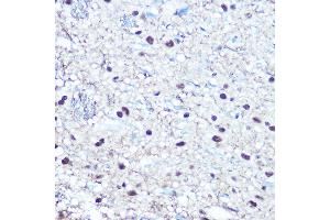 Immunohistochemistry of paraffin-embedded rat brain using Phospho-RB-S780 Rabbit pAb (ABIN3020471, ABIN3020472, ABIN3020473 and ABIN1681996) at dilution of 1:100 (40x lens). (Retinoblastoma 1 anticorps  (pSer780))
