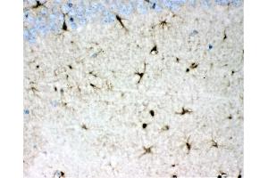 IHC analysis of DDAH1 using anti-DDAH1 antibody (ABIN4886560). (DDAH1 anticorps  (C-Term))