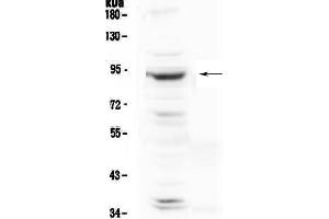 Western blot analysis of PLA2G6 using anti-PLA2G6 antibody . (PLA2G6 anticorps  (AA 715-802))