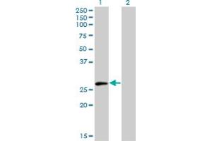 Western Blot analysis of ELF5 expression in transfected 293T cell line by ELF5 monoclonal antibody (M01), clone 3D10. (ELF5 anticorps  (AA 166-263))