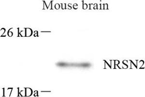 Western blot analysis of NRSN2 (ABIN7074806) at dilution of 1: 500