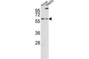 Western Blotting (WB) image for anti-Cryptochrome 2 (Photolyase-Like) (CRY2) antibody (ABIN3002520)