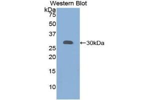 Western blot analysis of the recombinant protein. (Granulin anticorps  (AA 361-585))