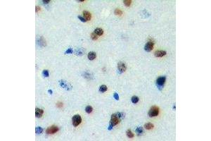 Immunohistochemical analysis of DYRK1B staining in human brain formalin fixed paraffin embedded tissue section.