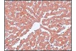 Immunohistochemistry (IHC) image for anti-Interleukin-1 Receptor-Associated Kinase 1 (IRAK1) (AA 618-712) antibody (ABIN492547)
