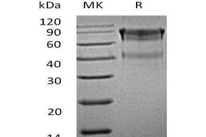 Western Blotting (WB) image for Interleukin 15 Receptor, alpha (IL15RA) (Active) protein (Fc Tag) (ABIN7320556)