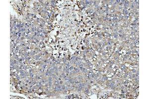 IHC analysis of DUSP6 using anti-DUSP6 antibody (ABIN7599332). (DUSP6 anticorps  (AA 1-381))