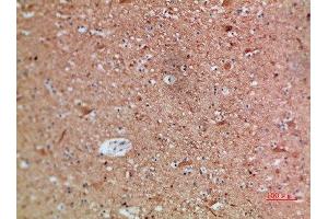 Immunohistochemical analysis of paraffin-embedded human-brain, antibody was diluted at 1:200