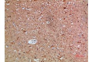 Immunohistochemical analysis of paraffin-embedded human-brain, antibody was diluted at 1:200 (ARTN anticorps  (AA 101-150))