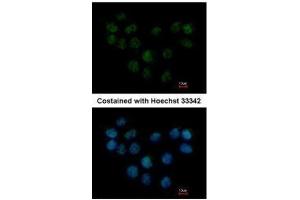 ICC/IF Image Immunofluorescence analysis of paraformaldehyde-fixed A431, using SMC1B, antibody at 1:500 dilution.