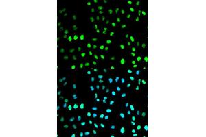 anti-Small Ubiquitin Related Modifier Protein 1 (SUMO1) (AA 1-101) antibody