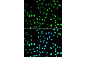 Immunofluorescence analysis of MCF7 cell using SUMO1 antibody. (SUMO1 anticorps  (AA 1-101))