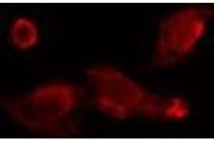 ABIN6275750 staining  Hela cells by IF/ICC. (BRE anticorps  (C-Term))