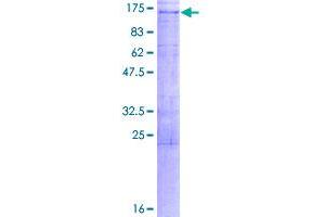 Image no. 1 for StAR-Related Lipid Transfer (START) Domain Containing 8 (STARD8) (AA 1-1023) protein (GST tag) (ABIN1321586)