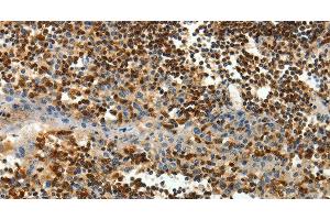 Immunohistochemistry of paraffin-embedded Human tonsil tissue using AMD1 Polyclonal Antibody at dilution 1:40 (AMD1 anticorps)