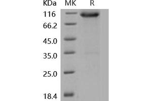 Western Blotting (WB) image for Fibroblast Growth Factor Receptor 3 (FGFR3) (Active) protein (His tag,Fc Tag) (ABIN7320454)