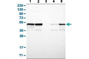 Western Blot analysis with PTPN1 polyclonal antibody . (PTPN1 anticorps  (AA 268-406))
