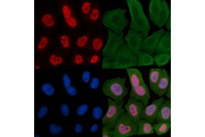 ABIN6256471 and ABIN6267557 staining Hela cells by IF/ICC.