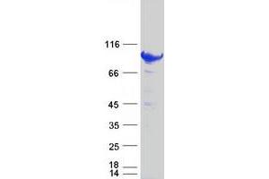 Validation with Western Blot (STAT5B Protein (Myc-DYKDDDDK Tag))
