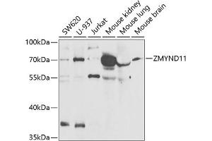 Western blot analysis of extracts of various cell lines, using ZMYND11 antibody (ABIN6133152, ABIN6150457, ABIN6150458 and ABIN6221937) at 1:1000 dilution.