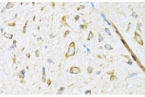 Immunohistochemistry of paraffin-embedded Mouse spinal cord using DNAJB11 Polyclonal Antibody at dilution of 1:100 (40x lens). (DNAJB11 anticorps)