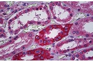 Human Kidney, Tubules: Formalin-Fixed, Paraffin-Embedded (FFPE) (CACNA2D2 anticorps  (AA 65-163))