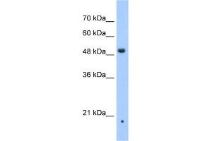 WB Suggested Anti-ZDHHC16 Antibody Titration:  0. (ZDHHC16 anticorps  (N-Term))