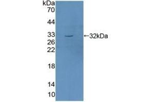 Detection of Recombinant SGK1, Mouse using Polyclonal Antibody to Serum/Glucocorticoid Regulated Kinase 1 (SGK1) (SGK1 anticorps  (AA 145-386))