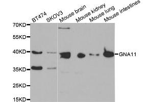 Western blot analysis of extracts of various cell lines, using GNA11 antibody (ABIN5971457) at 1:400 dilution.