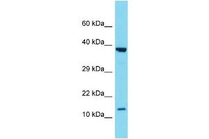 Western Blotting (WB) image for anti-Secretoglobin, Family 2A, Member 1 (SCGB2A1) (N-Term) antibody (ABIN2788420) (SCGB2A1 anticorps  (N-Term))
