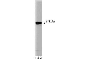 Western blot analysis of Eps8 on a lysate from mouse macrophages (RAW 264. (EPS8 anticorps  (AA 628-821))