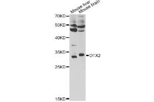 Western blot analysis of extracts of various cell lines, using OTX2 antibody (ABIN1876663) at 1:1000 dilution. (OTX2 anticorps)