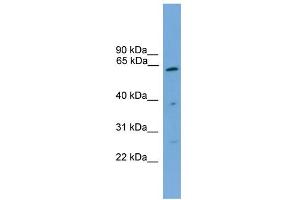 WB Suggested Anti-PSMD3 Antibody Titration: 0. (PSMD3 anticorps  (Middle Region))