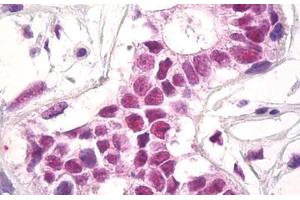 Image no. 1 for anti-REST Corepressor 1 (RCOR1) (AA 109-293) antibody (ABIN1490833)