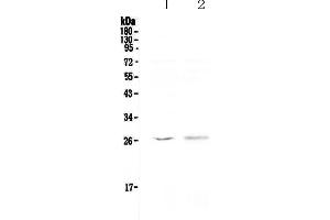 Western blot analysis of Kallikrein 6 using anti-Kallikrein 6 antibody . (Kallikrein 6 anticorps  (AA 22-244))